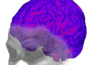 El origen de la enfermedad de Alzheimer puede estar en la evolución del ‘Homo sapiens’