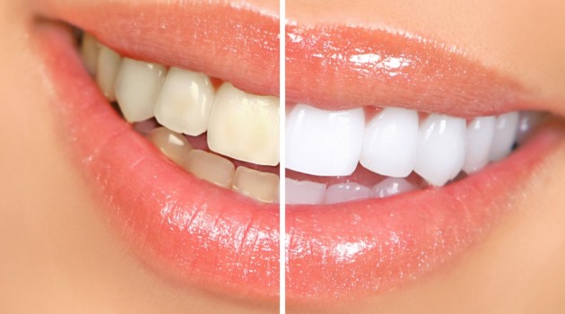 Mantén tus dientes blancos de manera natural