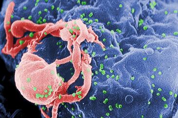 Viriones de VIH (verde) acoplándose a un linfocito. / Wikipedia